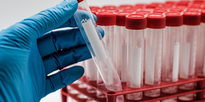 離心管的用途：購買離心管時應(yīng)考慮的事項