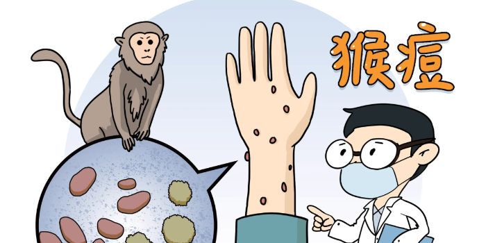 預(yù)防猴痘病毒 可從三方面入手