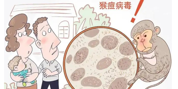 如何降低感染猴痘的風(fēng)險(xiǎn)？