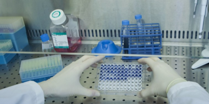 培養(yǎng)細(xì)胞需要哪些試劑耗材？