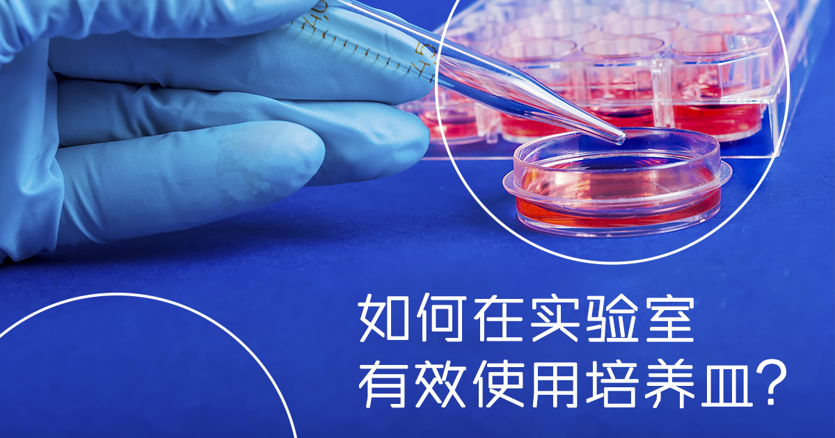 培養(yǎng)皿功能及其在實(shí)驗(yàn)室中的應(yīng)用