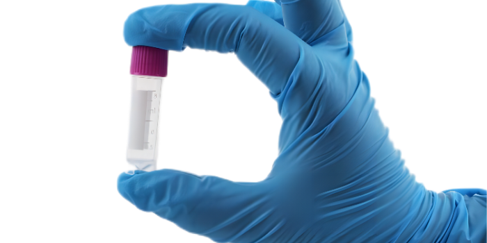 冷凍管“不適用于液氮液相”是什么意思？