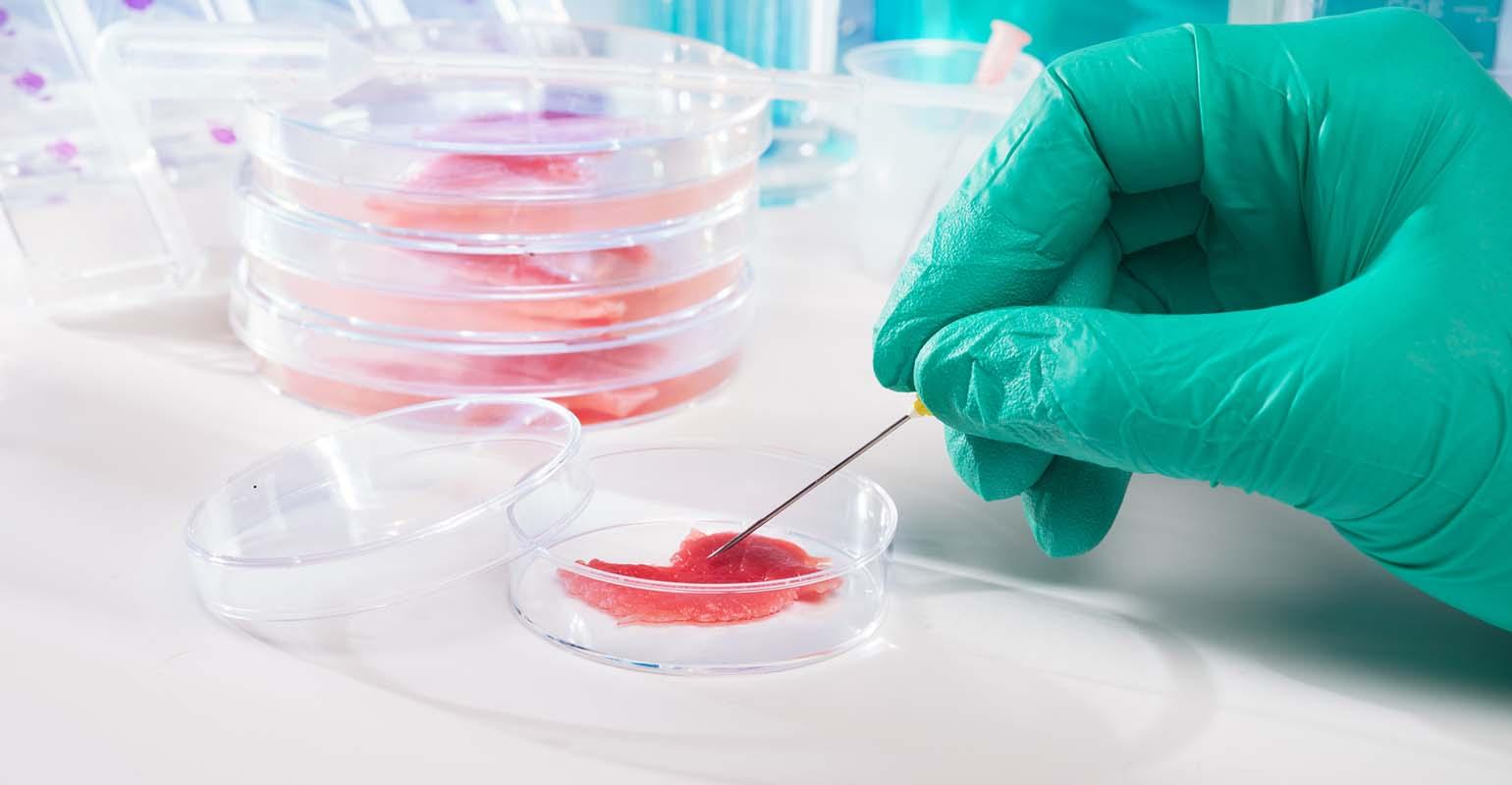 了解實驗室耗材：關(guān)于培養(yǎng)皿及其用途的一切