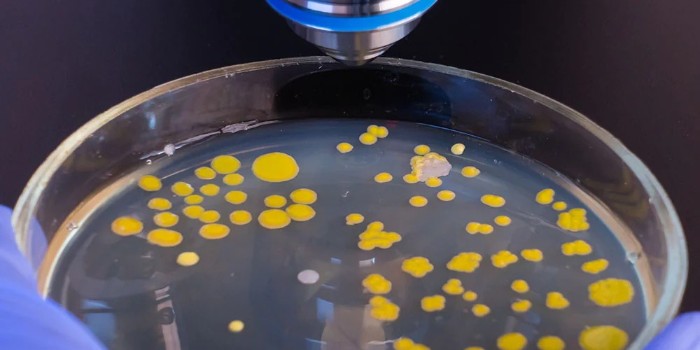 細菌培養(yǎng)試驗